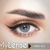 My Lense WebP 04 scaled 1.webp