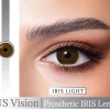 US VISION IRIS LENS WITH WM 01