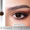 US VISION IRIS LENS WITH WM 02