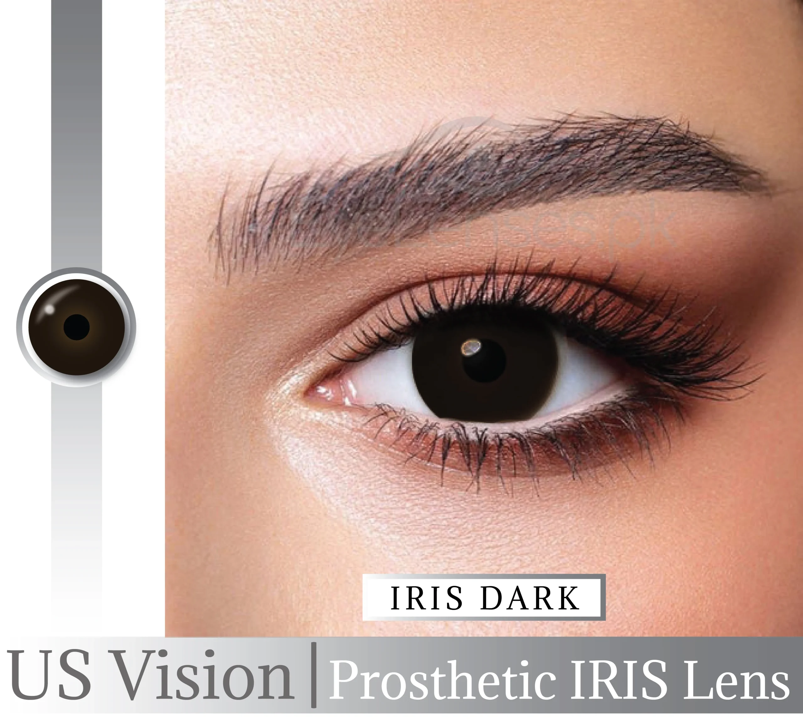 US VISION IRIS LENS WITH WM 03