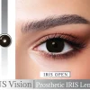 US VISION IRIS LENS WITH WM 04