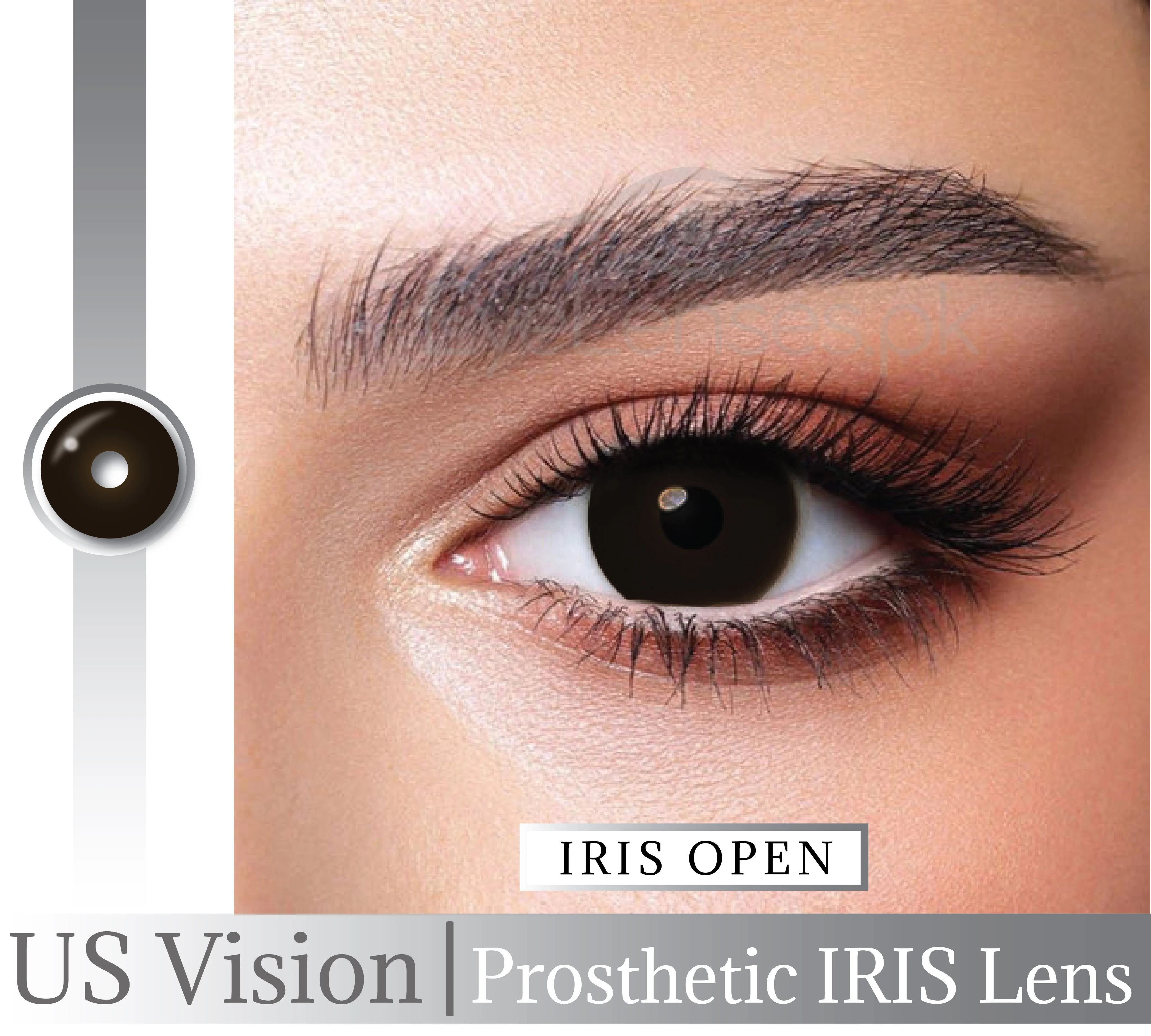 US VISION IRIS LENS WITH WM 04